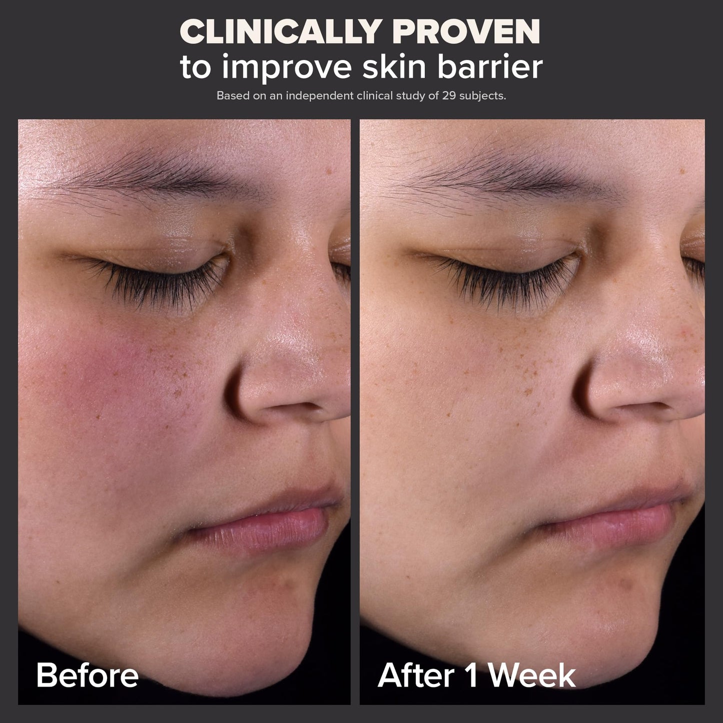 Paula's Choice Skin Perfecting 2% BHA Liquid Salicylic Acid Exfoliant Duo