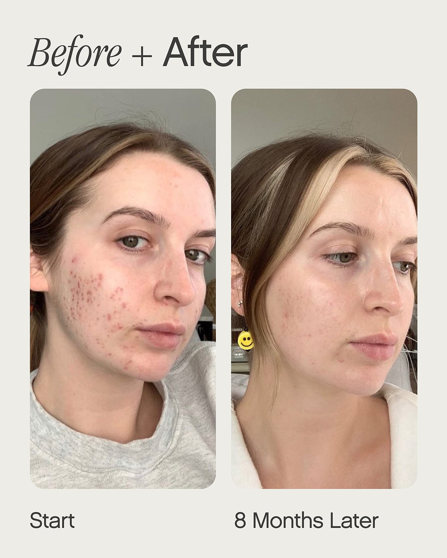 Topicals Faded Brightening and Clearing Serum/Reduces Discoloration/Post-Blemish Mark/Scar and Spots